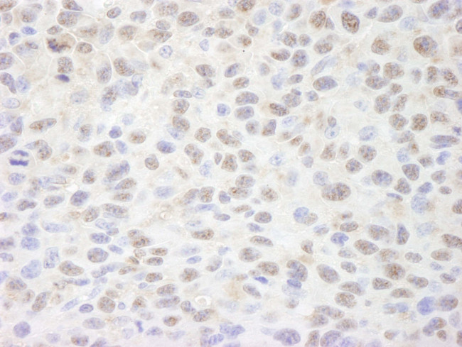 Sin3A Antibody in Immunohistochemistry (IHC)