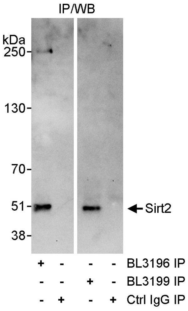 Sirt2 Antibody in Immunoprecipitation (IP)