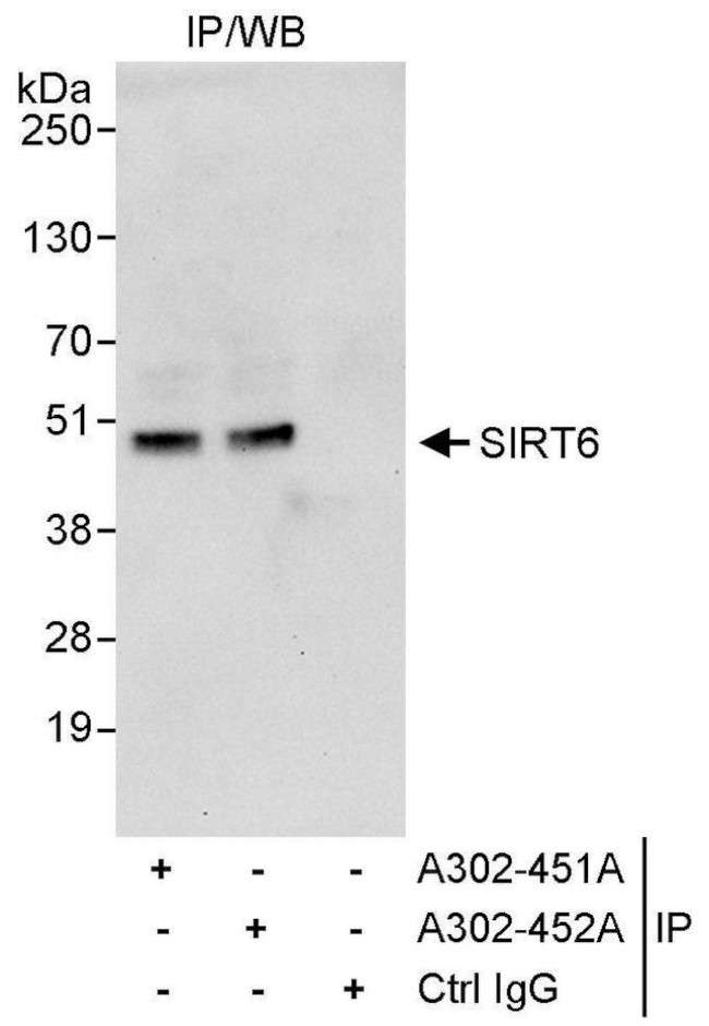 Sirt6 Antibody in Immunoprecipitation (IP)