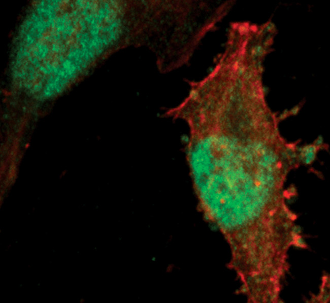 SMAD2 Antibody in Immunocytochemistry (ICC/IF)