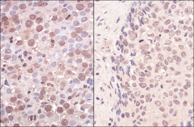 SmcHD1 Antibody in Immunohistochemistry (IHC)