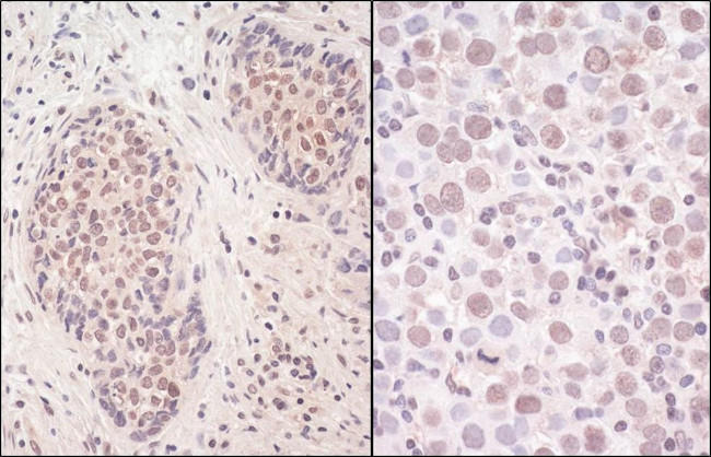 SmcHD1 Antibody in Immunohistochemistry (IHC)