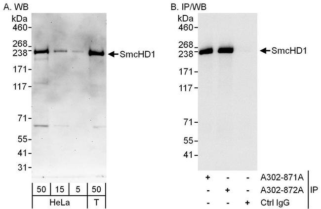 SmcHD1 Antibody in Western Blot (WB)