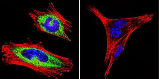 Sodium/Calcium Exchanger Antibody in Immunocytochemistry (ICC/IF)