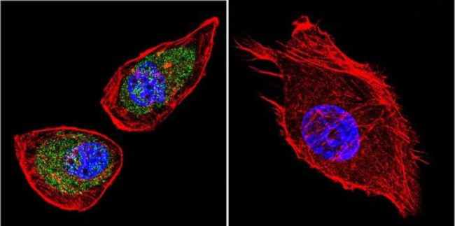 Sodium/Calcium Exchanger Antibody in Immunocytochemistry (ICC/IF)