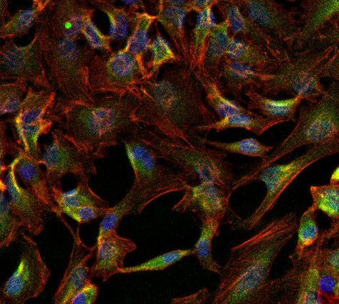 ATP1A1 Antibody in Immunocytochemistry (ICC/IF)