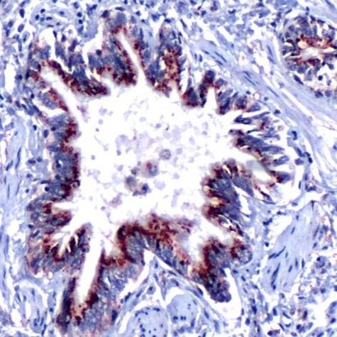 SHH Antibody in Immunohistochemistry (Paraffin) (IHC (P))