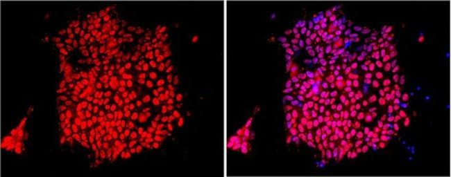 SOX2 Antibody in Immunocytochemistry (ICC/IF)