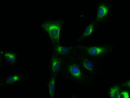 Sox17 Antibody in Immunocytochemistry (ICC/IF)