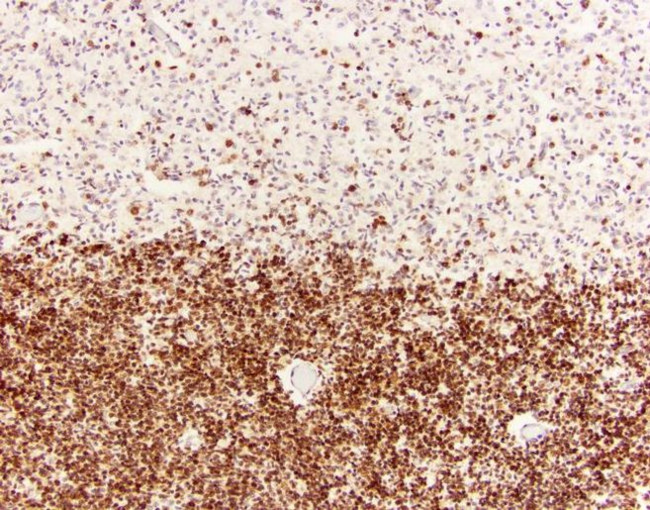 SOX2 Antibody in Immunohistochemistry (Paraffin) (IHC (P))