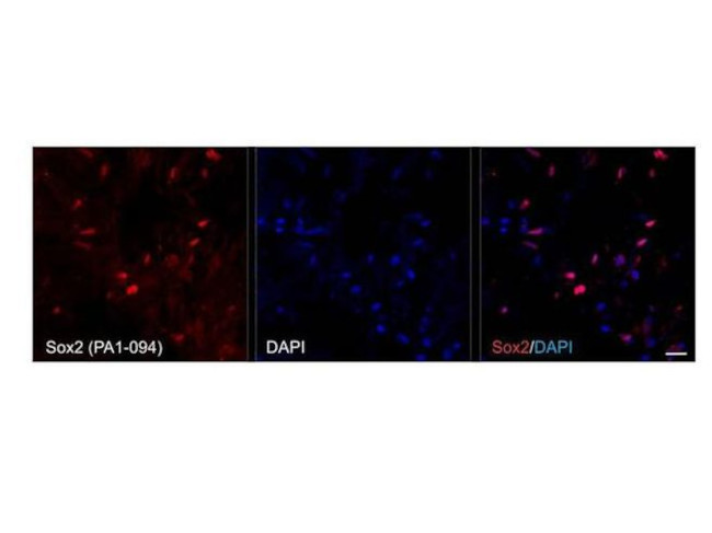 SOX2 Antibody in Immunohistochemistry (Frozen) (IHC (F))