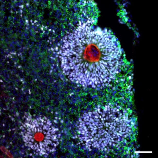 SOX2 Antibody in Immunohistochemistry (Frozen) (IHC (F))