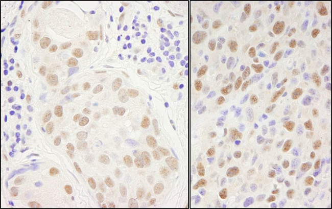 Sp1 Antibody in Immunohistochemistry (IHC)