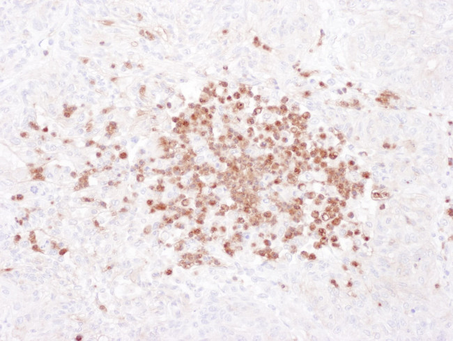 Stomatin Antibody in Immunohistochemistry (IHC)