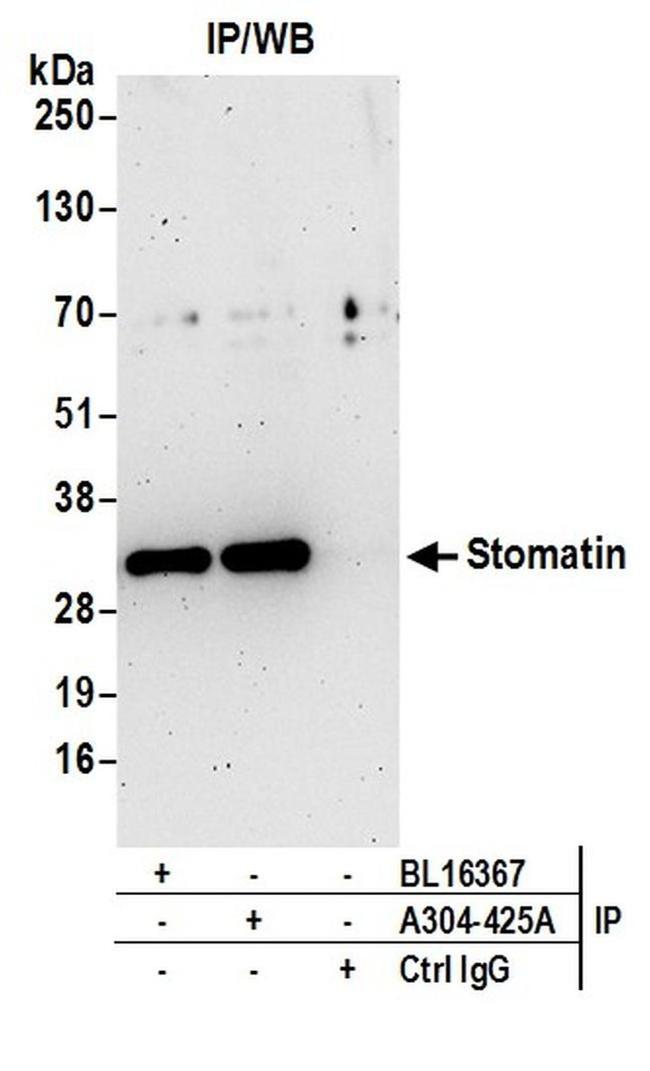 Stomatin Antibody in Western Blot (WB)