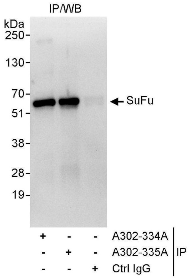 SuFu Antibody in Immunoprecipitation (IP)
