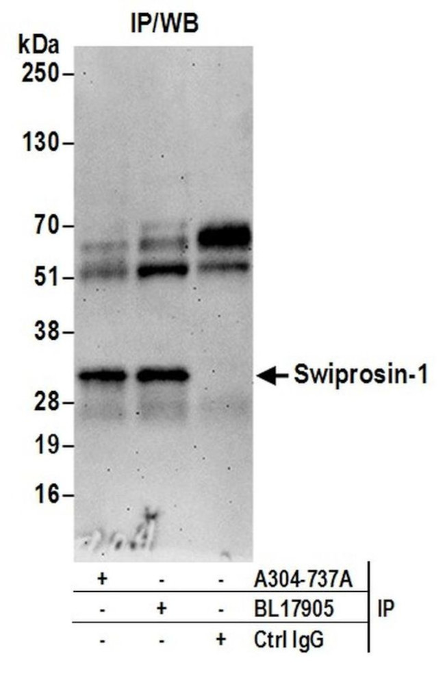 Swiprosin-1 Antibody in Immunoprecipitation (IP)