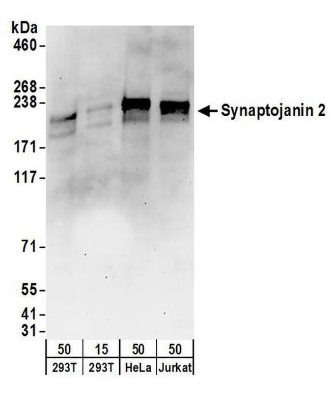 Synaptojanin 2 Antibody in Western Blot (WB)