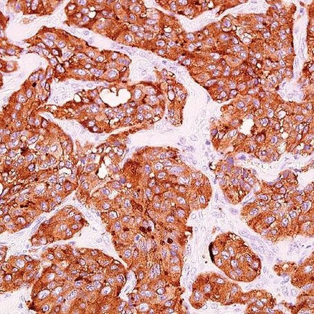 Synaptophysin Antibody in Immunohistochemistry (Paraffin) (IHC (P))