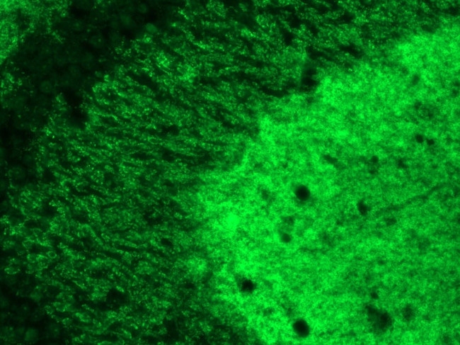 SynGAP Antibody in Immunohistochemistry (IHC)