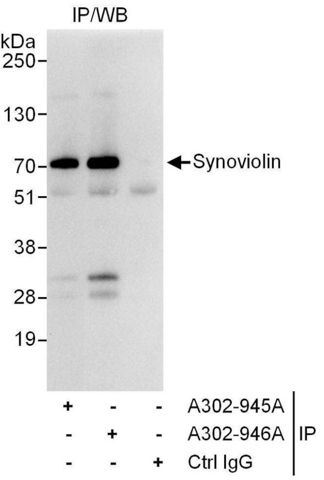 Synoviolin Antibody in Immunoprecipitation (IP)