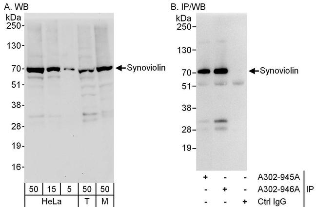 Synoviolin Antibody in Western Blot (WB)