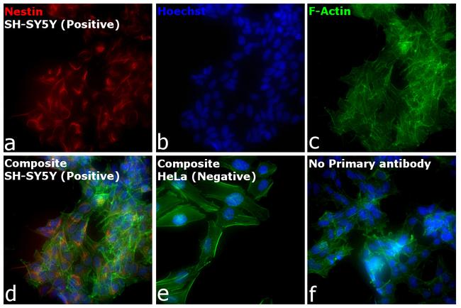 Mouse IgG (H+L) Cross-Adsorbed Secondary Antibody in Immunocytochemistry (ICC/IF)