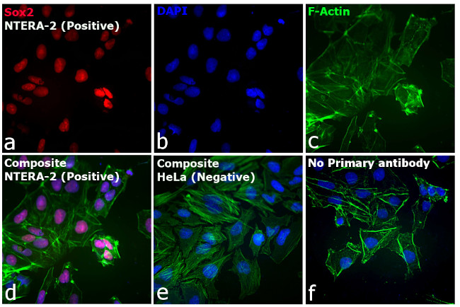 Rat IgG (H+L) Cross-Adsorbed Secondary Antibody in Immunocytochemistry (ICC/IF)