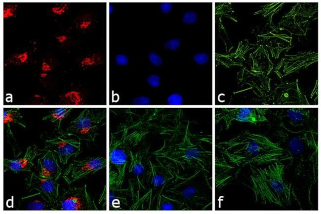 Rabbit IgG (H+L) Cross-Adsorbed Secondary Antibody in Immunocytochemistry (ICC/IF)