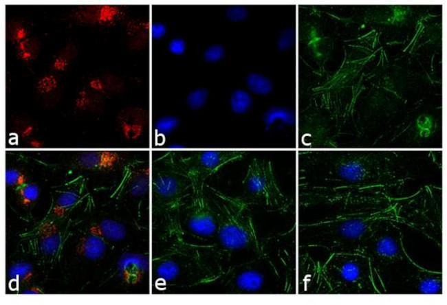 Rabbit IgG (H+L) Cross-Adsorbed Secondary Antibody in Immunocytochemistry (ICC/IF)