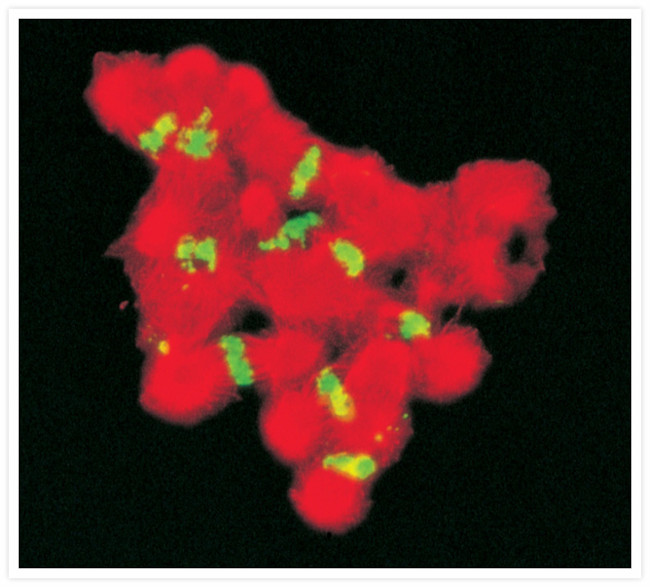 Rat IgG (H+L) Cross-Adsorbed Secondary Antibody in Immunocytochemistry (ICC/IF)