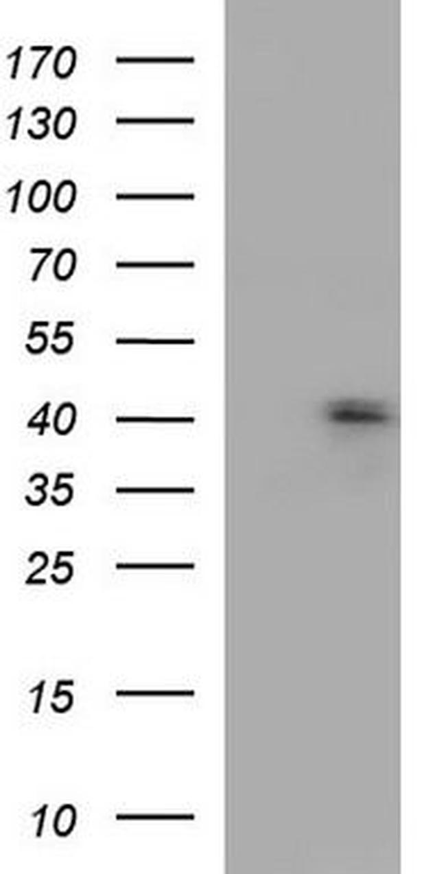 CCR2 Antibody in Western Blot (WB)