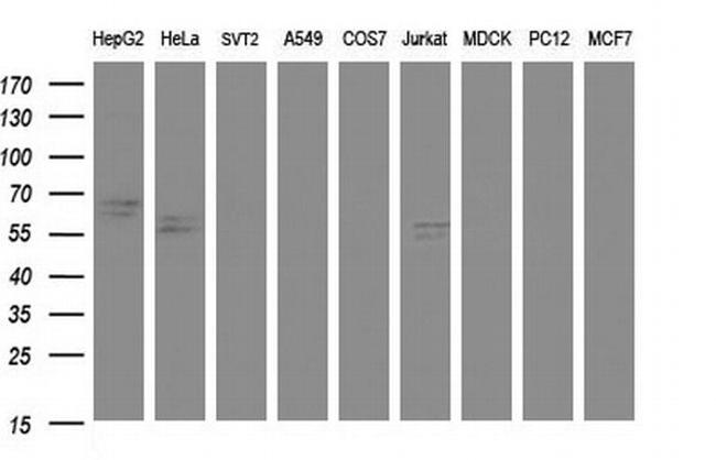 Alpha 1 Fetoprotein Antibody in Western Blot (WB)