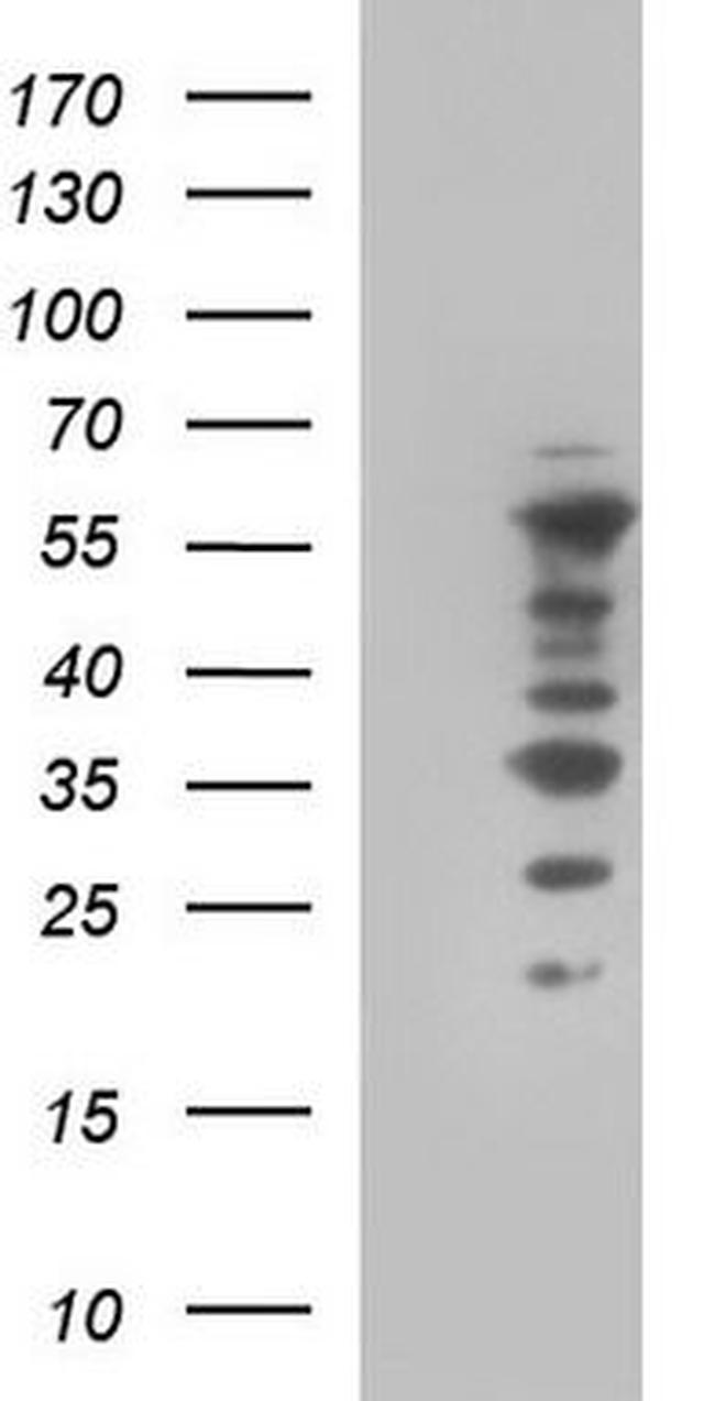 WIPF1/WIP Antibody in Western Blot (WB)