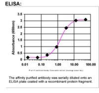 E-Cadherin Antibody in ELISA (ELISA)