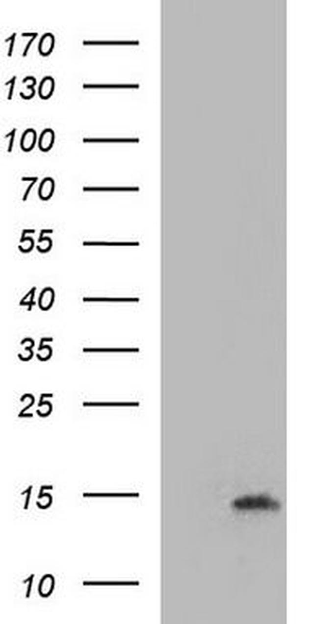 S100 alpha 2 Antibody in Western Blot (WB)