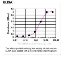 ABCF2 Antibody in ELISA (ELISA)