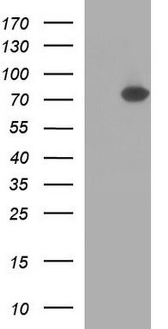 EHD2 Antibody in Western Blot (WB)