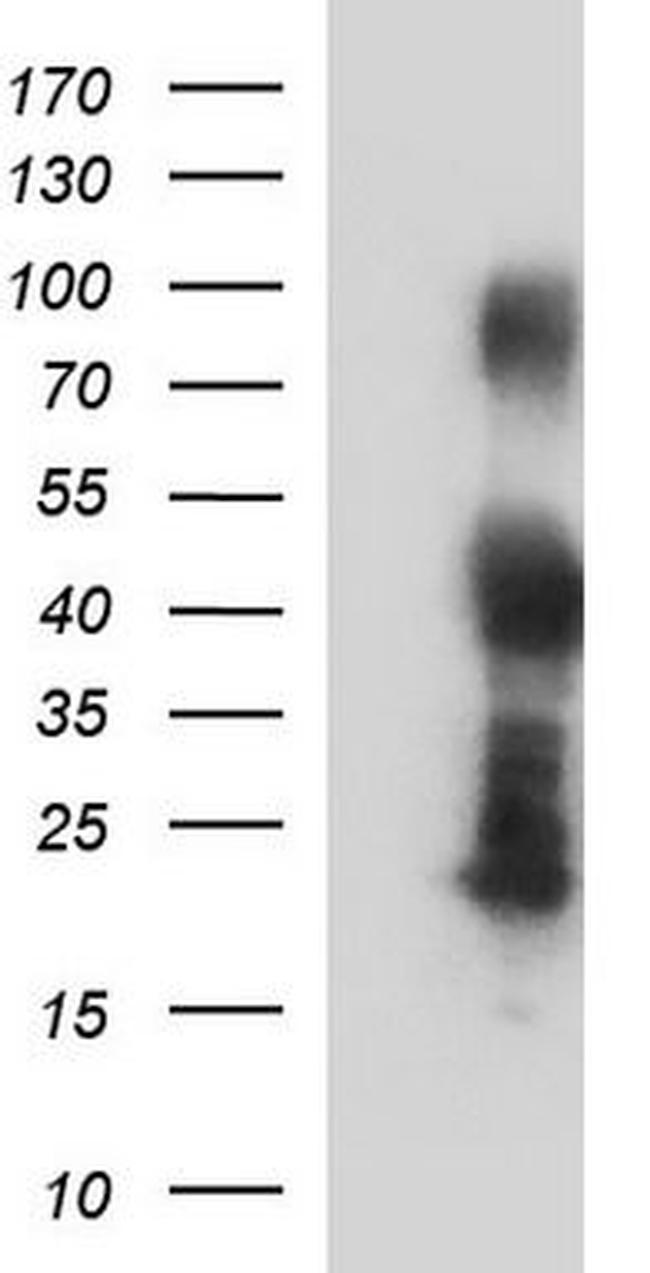 HIC5 Antibody in Western Blot (WB)