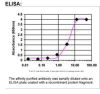 SCN3B Antibody in ELISA (ELISA)