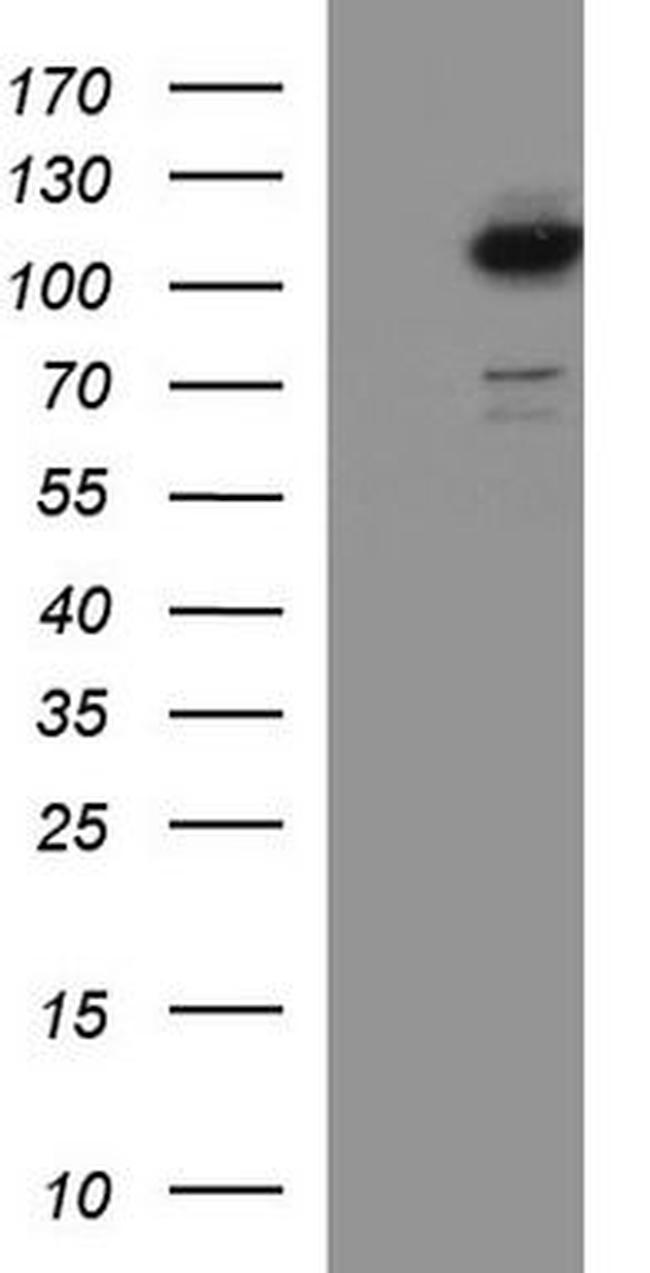 VEPH1 Antibody in Western Blot (WB)