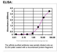 Fibronectin Antibody in ELISA (ELISA)