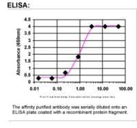 EGFR Antibody in ELISA (ELISA)