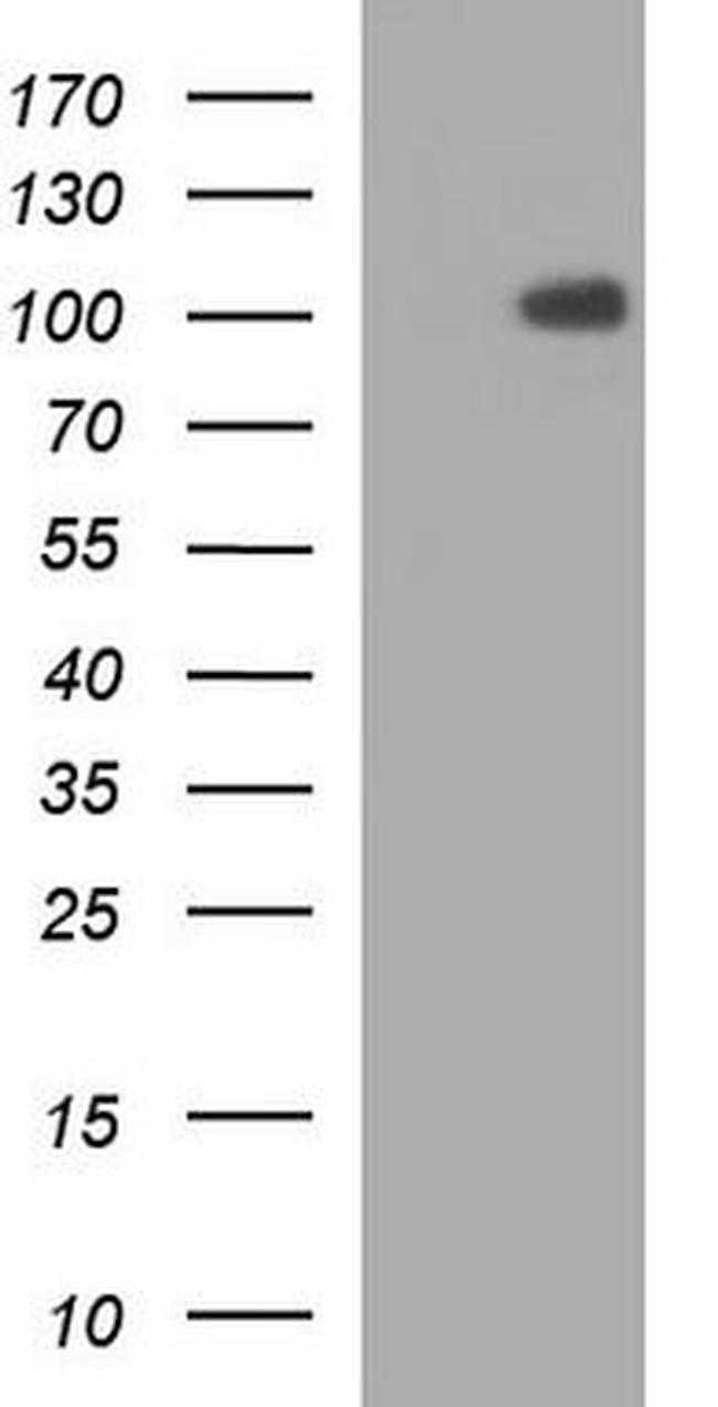 NCAM Antibody in Western Blot (WB)