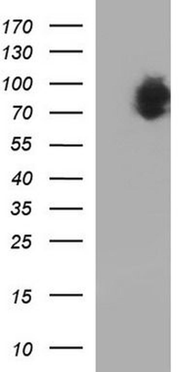 FIP1/RCP Antibody in Western Blot (WB)