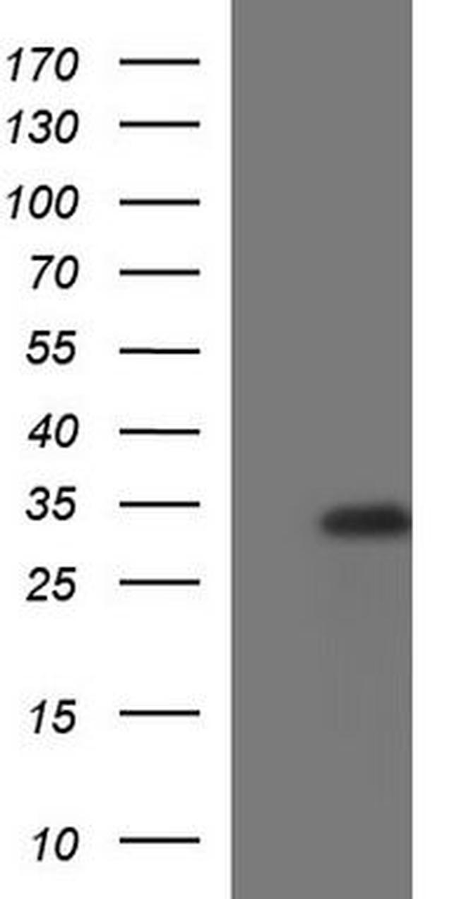 TGF beta induced factor 2 Antibody in Western Blot (WB)