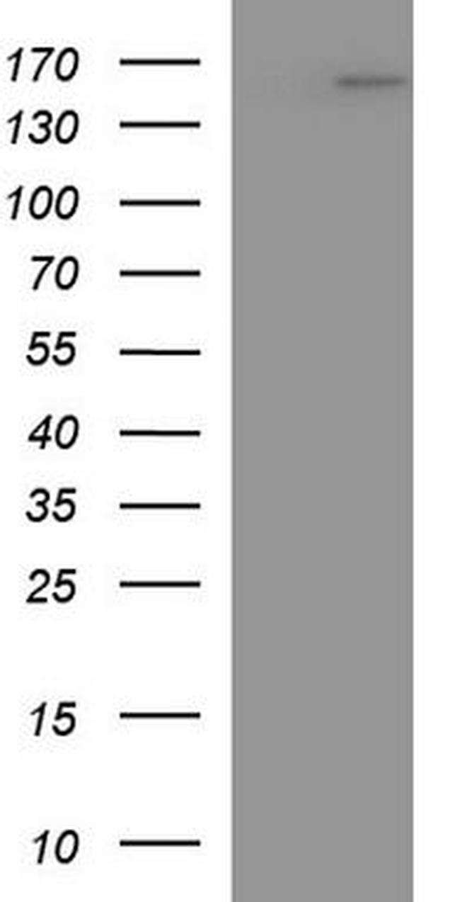 LAMC2 Antibody in Western Blot (WB)