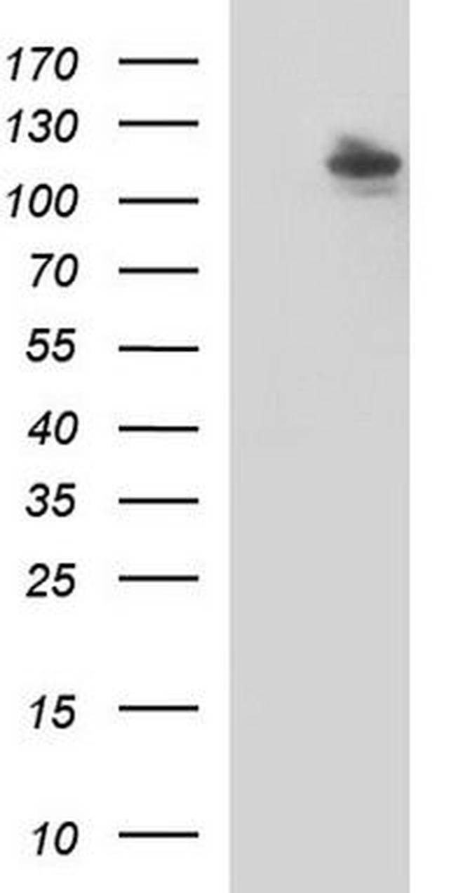 ECT2 Antibody in Western Blot (WB)