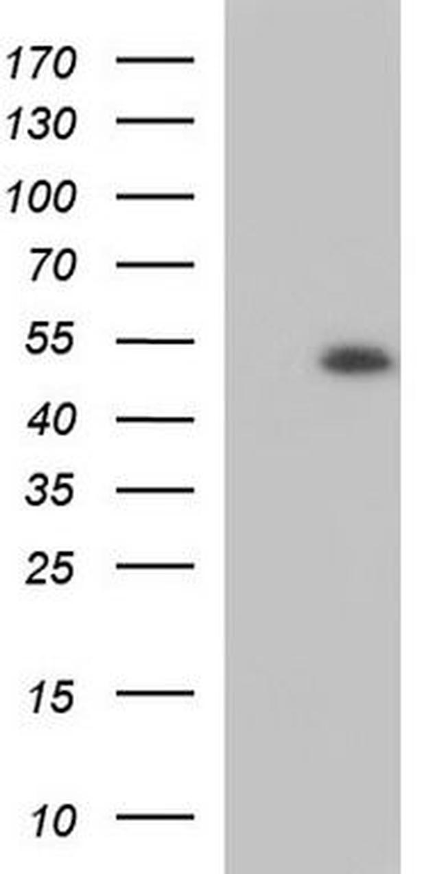 ACP6 Antibody in Western Blot (WB)