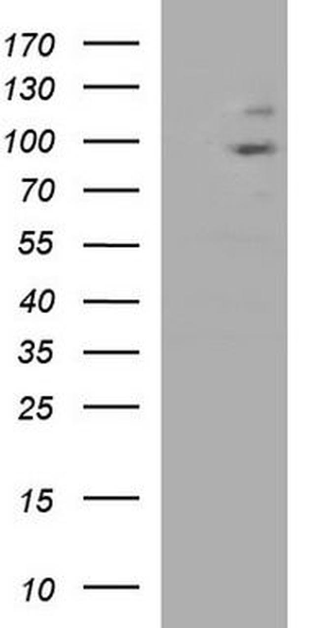 PHF16 Antibody in Western Blot (WB)